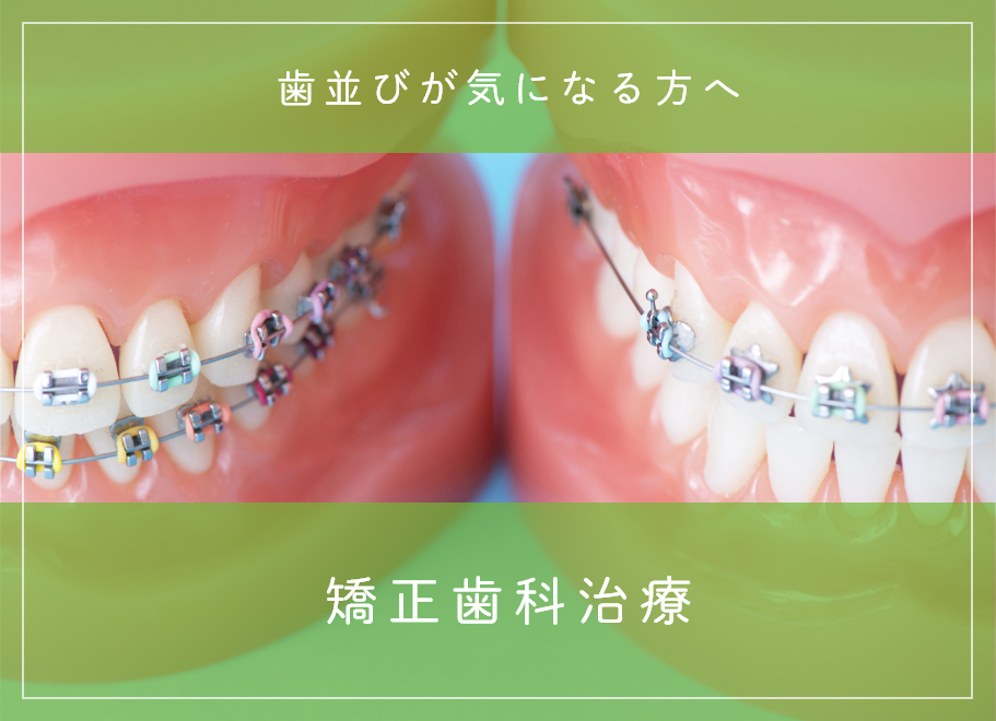 矯正歯科治療 歯並びが気になる方へ
